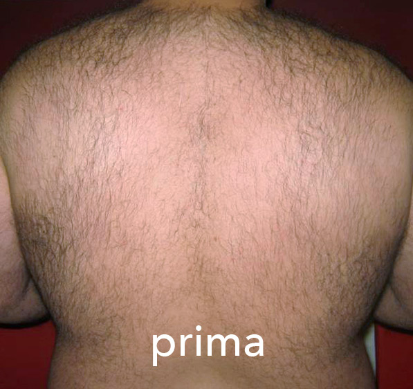 Stardust Med – prije tretmana (primjer 1)